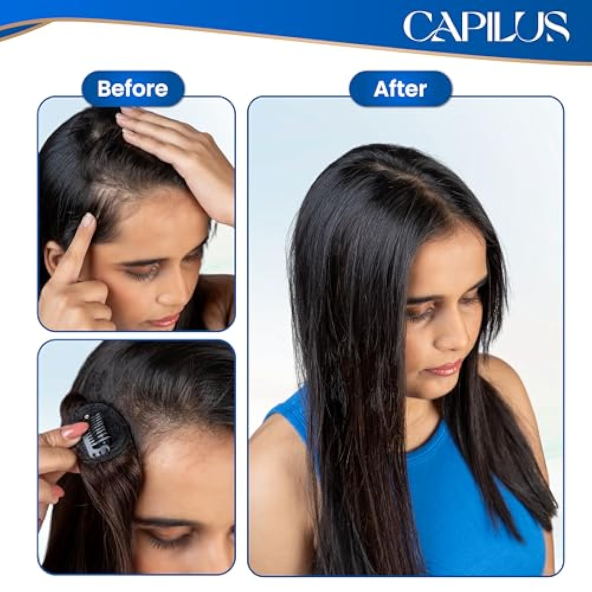Invisible Hair Patch 100% Indian Human Hair Extensions