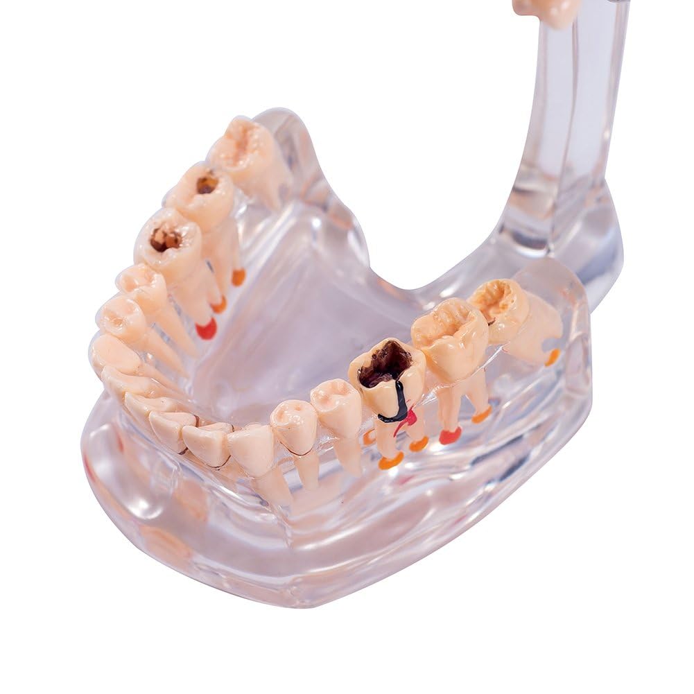 Amazon.co.jp: 歯列模型 歯科模型 指導模型 (HSTC1Q) : 産業・研究開発用品