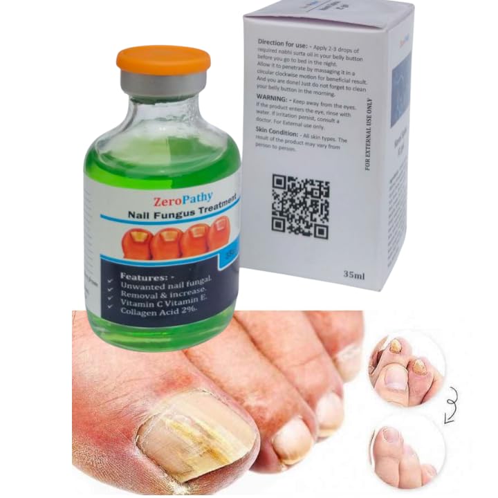 Image of Herbal Nail Treatment Lotion for Dry, Fungal, and Broken Nails | Encourages Healthy Nail Growth with Ayurvedic Power | Soothes Nail Beds, Repairs Texture, and Prevents Nail Lifting and Cracking