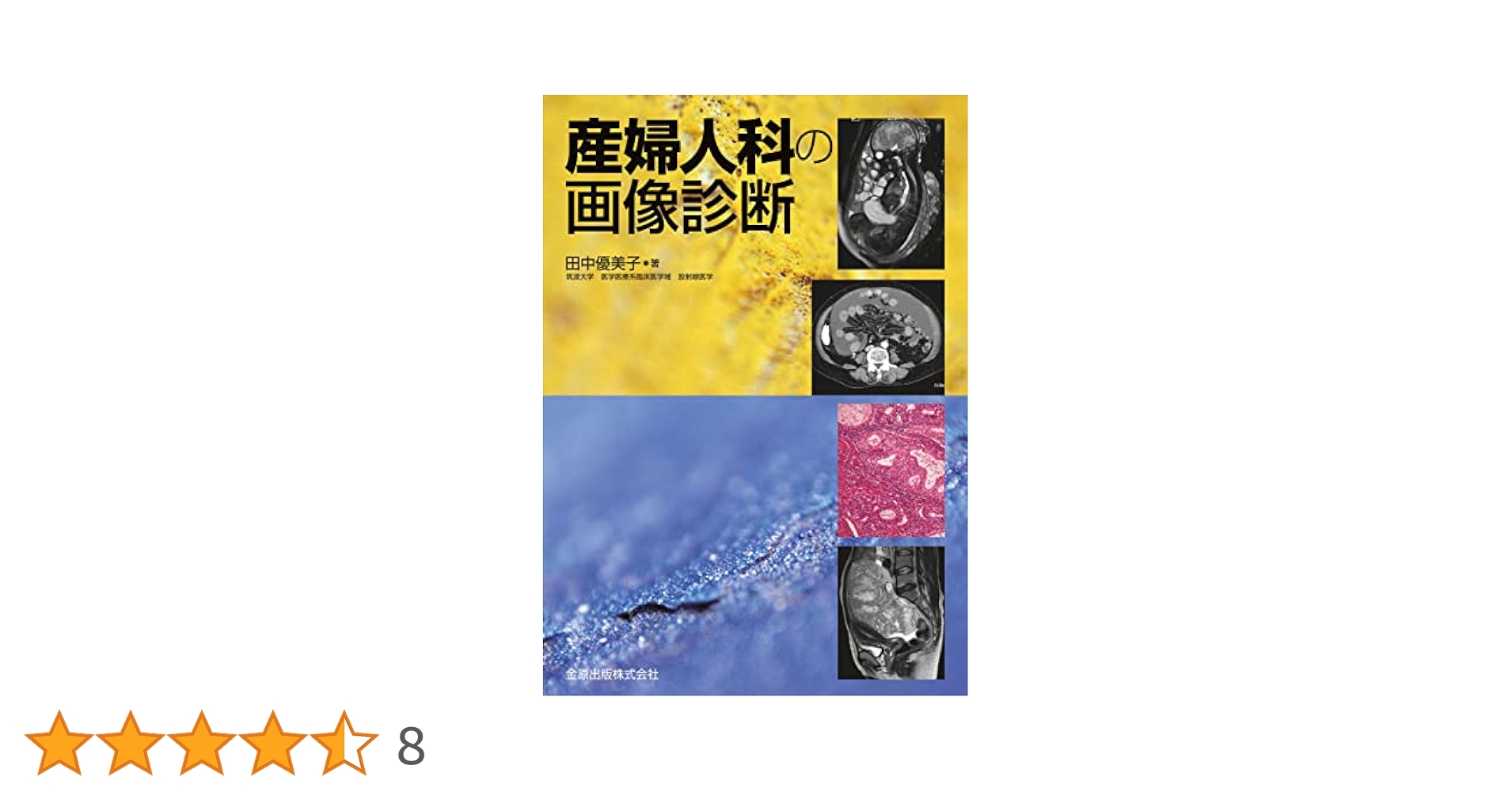【医学書】産婦人科の画像診断 産婦人科の画像診断 | 田中優美子 |本 | 通販 | Amazon