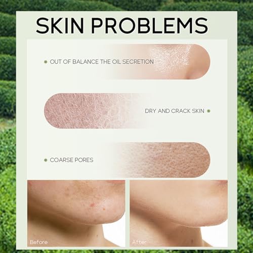 Green-Tea-Skincare-Set-19-In-1-Skincare-Gift-Set-with-Cleanser-Face-Serum-Face-Cream-Eye-Cream-Mask-And-Mud-Mask-Skincare-Kits-For-Teen-Girls-Hydrating-Facial-Kit-For-Women