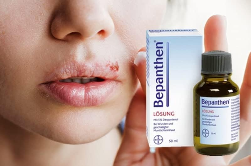 Miniatura 2 de Quartett Bepanthen - Solución bucal con dexpantenol para el tratamiento de pequeñas lesiones de la mucosa oral, tintes y sin fragancia, 1.7fl oz