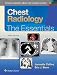 Chest Radiology: The Essentials (Essentials Series)