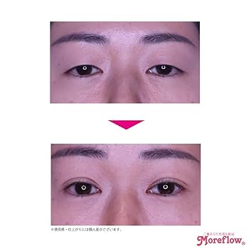 Amazon.co.jp: Moreflow モアフロウ アイリッドリキッド 8ml