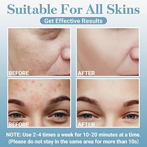 Uaike High Frequency Facial Wand thumb #3