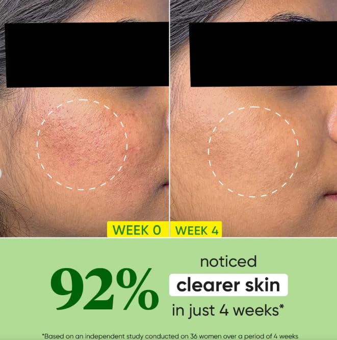 Dot & Key Cical Calming Oil Free Moisturizer for Acne Prone SKin, 60 g (Pack of 1) - Image 3