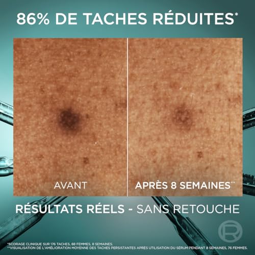 'oréal paris bright reveal sérum anti tâches 30ml - vue 6