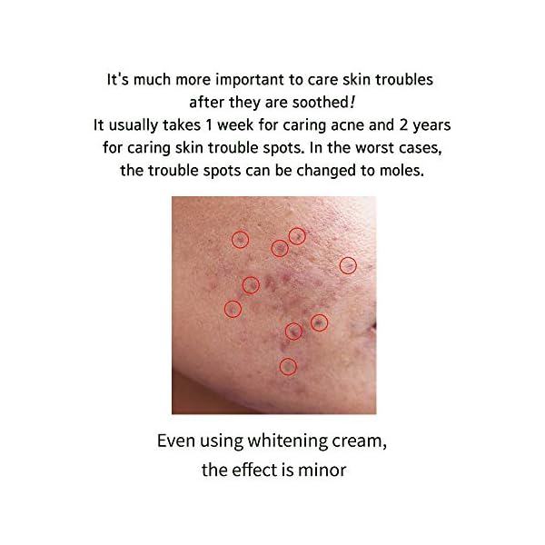 CURESYS-Dark-Spot-AC-Patch3EA-27-patches--Microneedle-Patch-Hyperpigmentation-Treatment-Blemish-Patch-Dark-Spot-Corrector-Acne-Spot-Treatment-Post-Pimple-Dark-Spot-Brightening-Patch CURESYS Dark Spot AC Patch(3EA, 27 patches) – Microneedle Patch | Hyperpigmentation Treatment | Blemish Patch | Dark Spot Corrector | Acne Spot Treatment | Post Pimple Dark Spot Brightening Patch