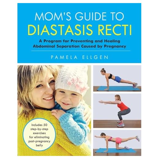 Mom's Guide to Diastasis Recti: A Program for Preventing and Healing Abdominal Separation Caused by Pregnancy