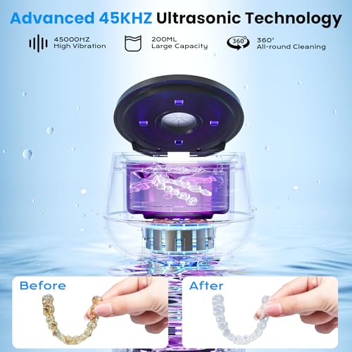 Save $13 on Ultrasonic Retainer Cleaner with Code S8MQ7YG4