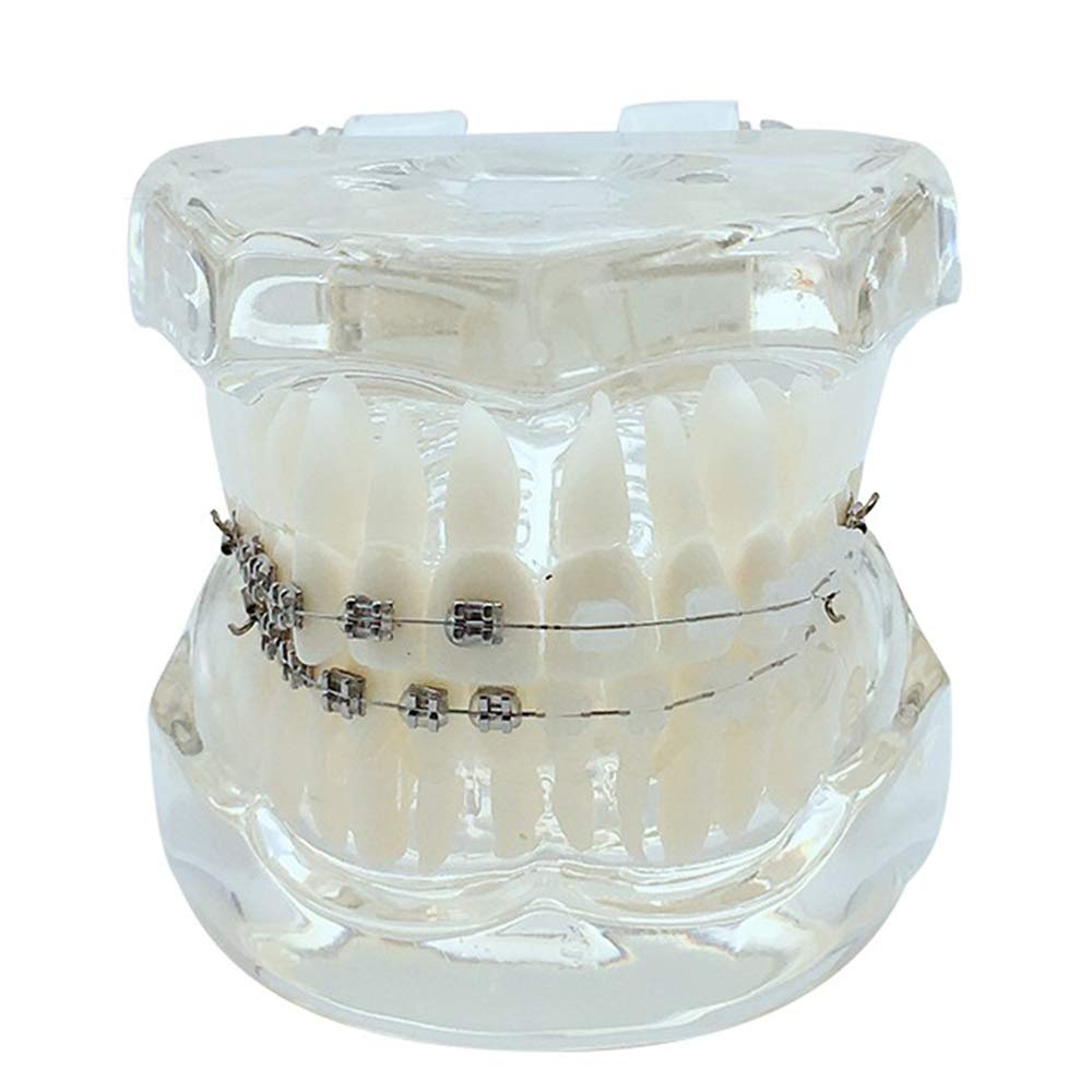 Sjdopulse A Tooth Orthodontic Model - Teeth Teaching Model - Half Ceramic Half Metal Dental Model - Dental Study Teaching Model - For Teaching Demonstration (A)