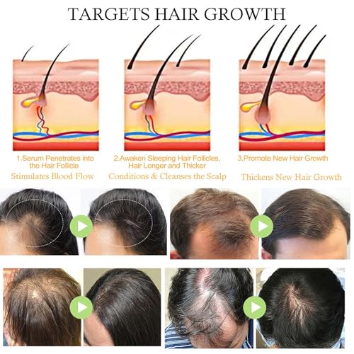 Huile Pousse Cheveux Très Rapide,Huile Cheveux Pousse Contre la Perte de Cheveux Femme,Avec du Café Vert, de l'huile de Coco et de l'huile de Romarin,Favorise des Plus Épais – vue 7