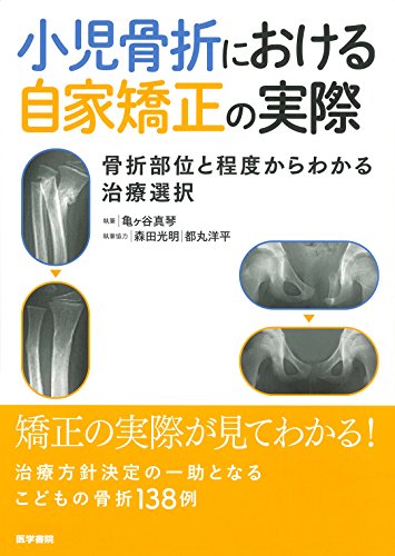 無料電子書籍 pdf 小児骨折における自家矯正の実際 骨折部位と程度からわかる治療選択 バイ
