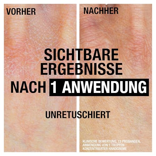 Neutrogena Intense Repair CICA Handcreme Feuchtigkeitscreme mit 45 Prozent Glycerin + Centella Asiatica für sehr trockene, juckende Hände