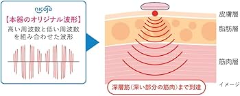 Amazon | スマート低周波 NK5020 パールピンク 低周波治療器