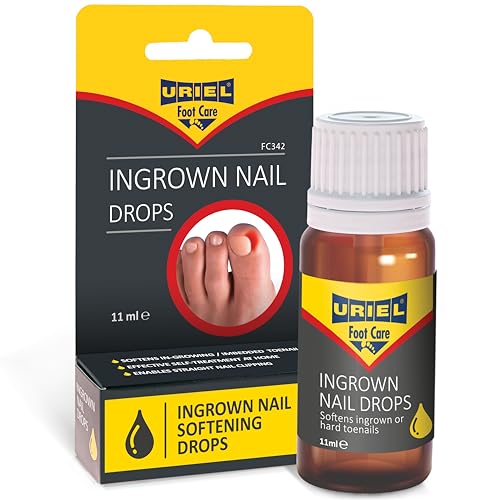Best Ingrown Toenail Drops Top Solutions for Pain Relief and Healing