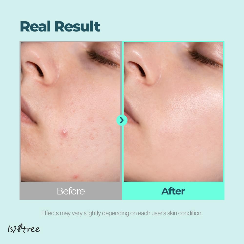 IsNtree Gim PDRN Deep Sleep Mask 80ml, 2.7 fl oz | Korean SEAWEED Skincare Sleeping Mask gel | Night Cream | Facial Mask | Overnight Gel mask for Hydration & Skin Bounce - Image 5