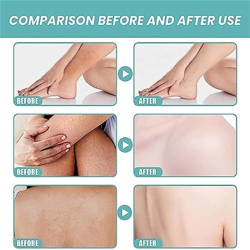Aceite de baño para piel suave que elimina la sequedad extrema 4