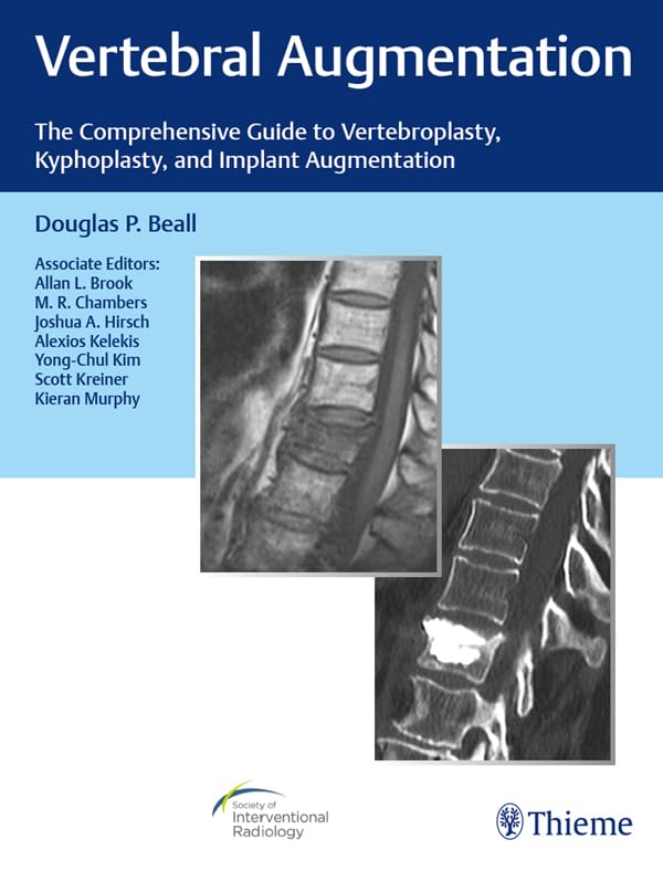 Vertebral Augmentation: The Comprehensive Guide to Vertebroplasty, Kyphoplasty, and Implant Augmentation      1st Edition, Kindle Edition