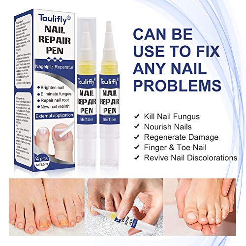 Nagelpflege und Behandlung,Nagelpflege Stift, Nagel Behandlung, Entfernen Ablagerungen, zum gebrochene Nägel für gesunde… – Bild 4