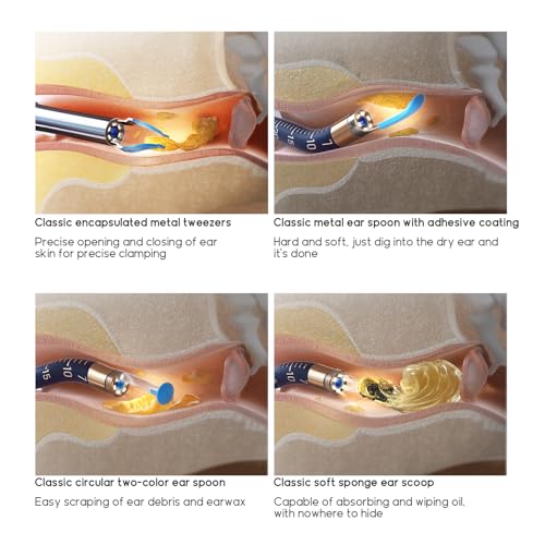 Image of Bebird Original Ear Camera Replacement Tips Apply to Earsight Plus&R1 Ultra