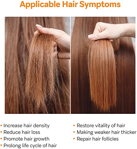 image for AZALLY Hair Growth Serum, Ginger Hair Growth Oil , Best Hair Loss Prev