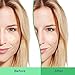 Differin Acne Face Wash with 5% Benzoyl Peroxide, Daily Deep Cleanser by the makers of Differin Gel, Gentle Skin Care for Acne Prone Sensitive Skin, 4 oz (Packaging May Vary) (Pack of 2)