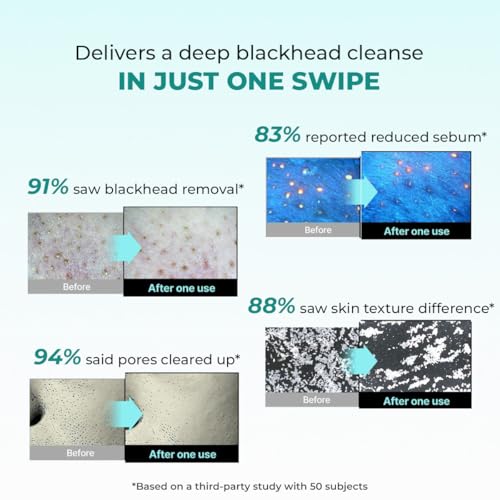 Image of Conscious Chemist Blackhead Melting Water | 50ml | Gentle Pore treatment with Succinic, Glycolic Acid & CICA Exosome | Unclogs Pores, Dissolves Blackheads & Smoothens Skin | Toner For Men & Women
