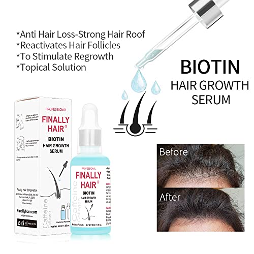 Finally-BIOTIN-CALLOGEN-CAFFEINE-Hair-Growth-HAIR-LOSS-TREATMENT-SERUM-Grow-Your-Hair-Back-PROMOTES-HAIR-GROWTH-for-Women
