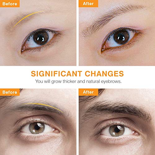image for FQQF Eyelash Growth Serum -100% Natural Lash Growth Serum & Lash Boost