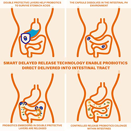 Prebiotics & Probiotics For Women And Men - Probiotics 60 Billion, 19 Strains Acidophilus Probiotic Supplement For Gut Digestive, Immune, Feminine Health, Shelf Stable Soy & Dairy Free | 60 Vegan Caps #TOP6