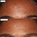 Sunday Riley Good Genes All-in-One Lactic Acid Treatment Face Serum
