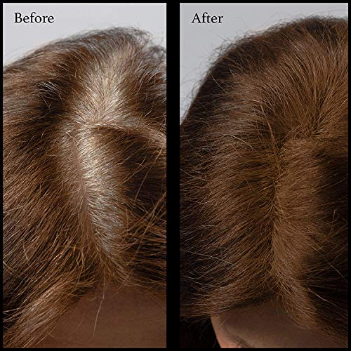 Hair Root Touch Up Powder – Root Cover Up Hair Powder – 11 True-To-Nature Root Concealer Shades – Zero Fragrance, Talc Or Parabens – Hair Cover Hairline Powder By Nubeauti (With Brush, Light Auburn) #TOP2