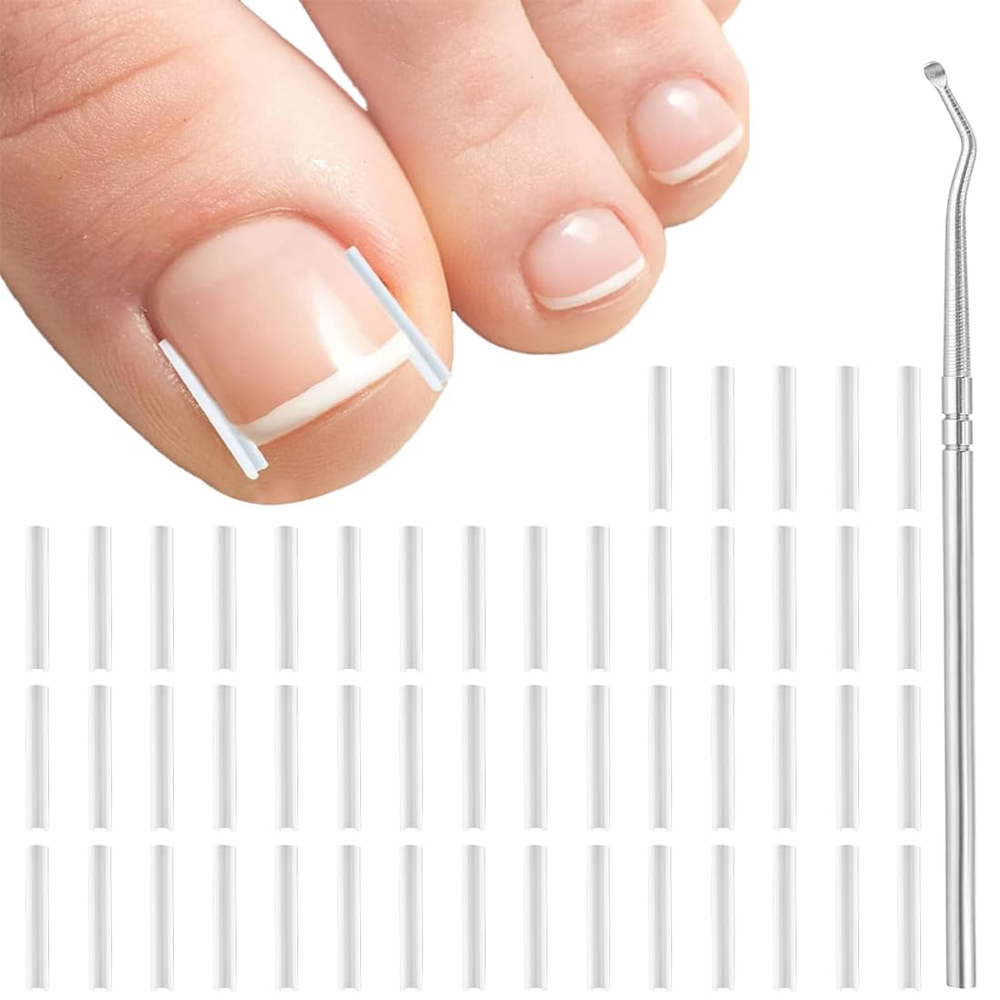 51 Piezas Juego de correctores para uñas encarnadas: tiras alisadoras de uñas sin dolor con elevador de uñas: kit de herramientas para uñas encarnadas de fácil uso