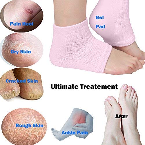 Codream Moisturizing Gel Heel Sleeves and Gloves, Gel SPA Gloves Socks Repair Cracked Skin and Exfoliate Skin,Soften Beauty Hands and Feet for Women