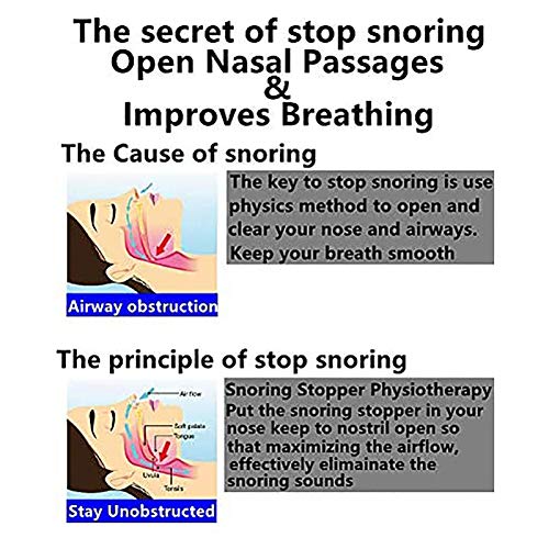 Ronco Bastião Grande Pequeno Dilatador Nasal - Dispositivo Dilatador Nasal Anti Ronco, Dilatador Nas
