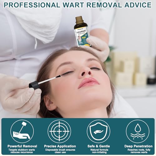Image of Skin Tag Remover,Wart Remover Freeze Off Liquid with 17% Salicylic Acid - Fast-Acting Freeze Off Treatment for Common & Plantar Warts,Flat Wart, Corns - for Feet, Hands & Body 1Ounce