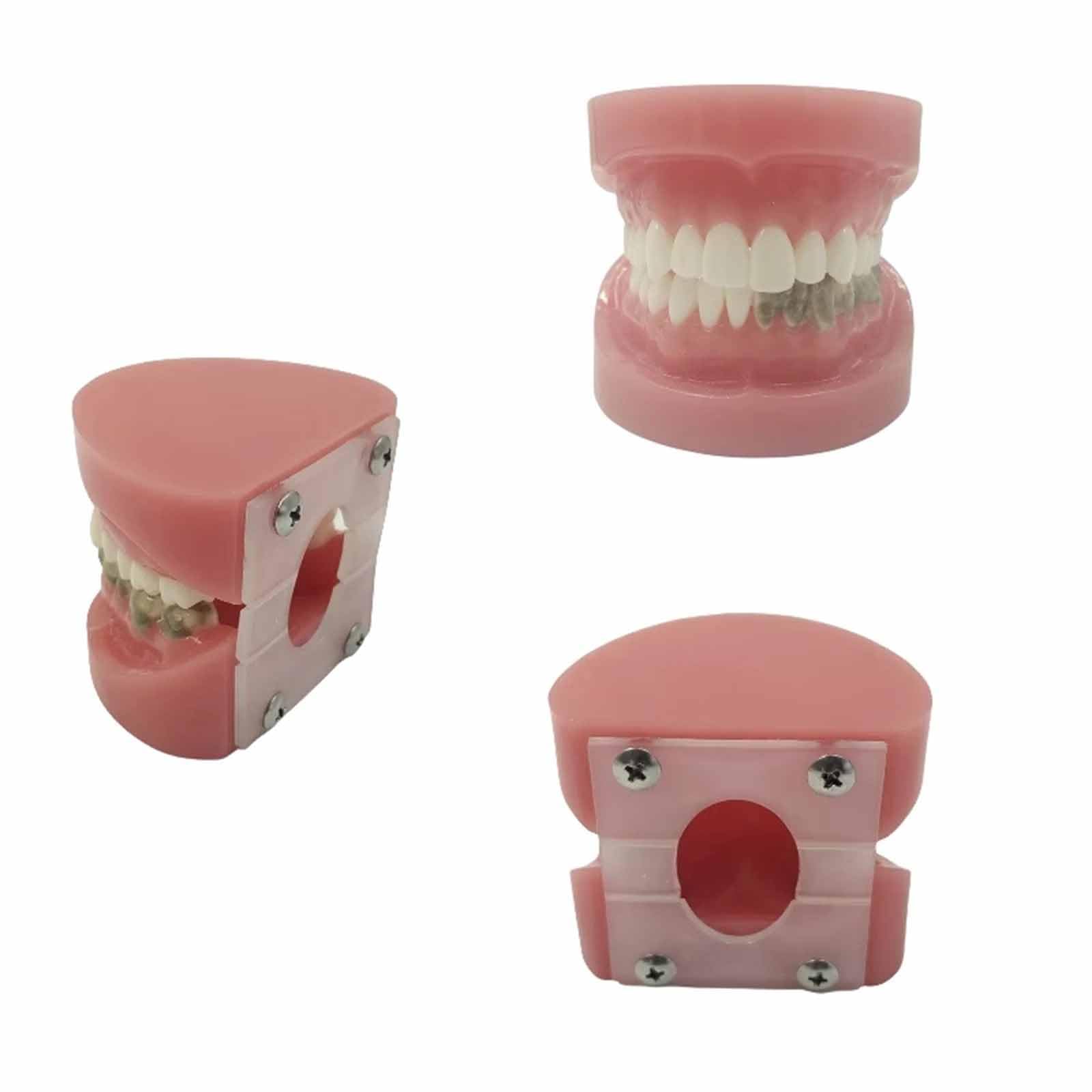 Model Zębów, Model Ekspozycyjny Z Nicią Dentystyczną, Do Nauki, Dla Dentystów, Studentów Stomatologii, Czysty Eksponat (Skóra 8 Cm),Flesh-8cm