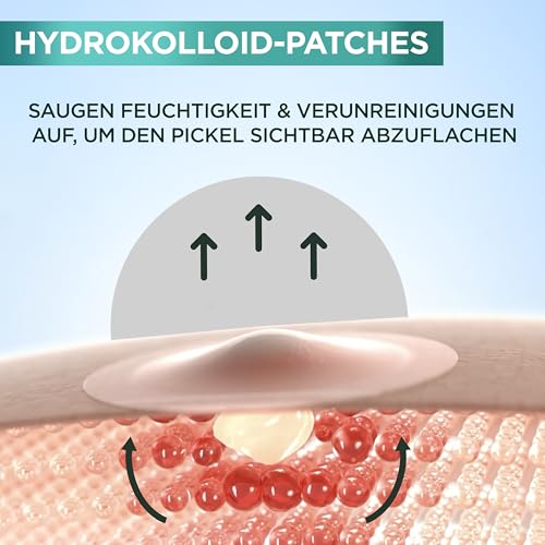 Garnier Hautklar Pimple Patches Invisible, unsichtbare Hydrokolloid Anti Pickel Patches mildern Sichtbarkeit in 8H, XXL Pack mit 44 Stück, gezielt gegen Pickel & Akne 4