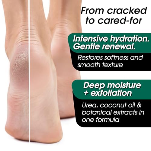 Urea Cream 40 Percent for Feet Maximum Strength – Intensive Foot Repair & Cracked Heel Treatment – Athletes Foot Treatment Peel Mask – 40% Lotion for Extremely Dry Skin & Hand Cream for Women & Men