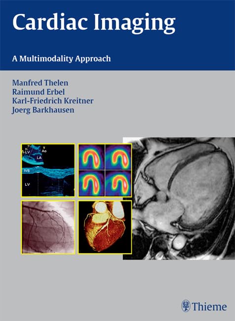Cardiac Imaging: A Multimodality Approach