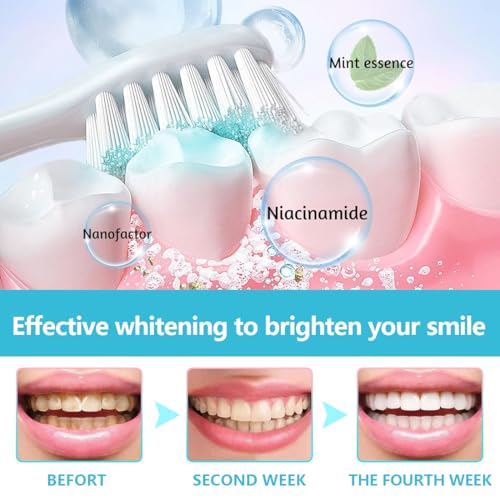 1 Stück Radiant Whitening Zahnpasta, Niacinamide Whitening Toothpaste, Zahnpasta Weisse Zähne, Niacinamid Zahnpasta, Whitening Zahnpasta fördert eine natürliche Zahnaufhellung & Frischer Atem,A – Bild 6