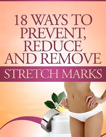 18 Ways to Prevent, Reduce and Remove Stretch Marks-Wow! eBook