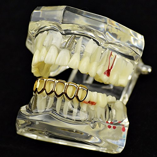 14K Gold Plated Open Face Grillz Six Tooth Lower Row Bottom Teeth Hip Hop Mouth Grills #TOP23