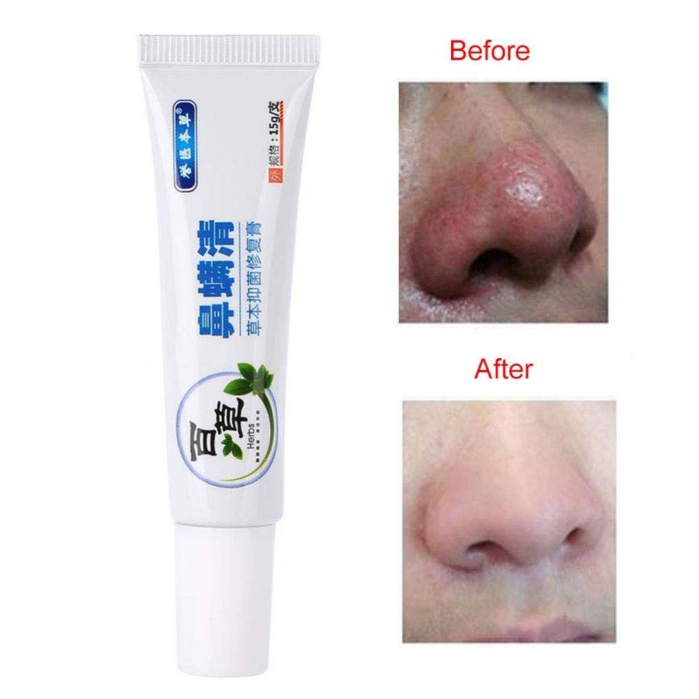 rosacea care products