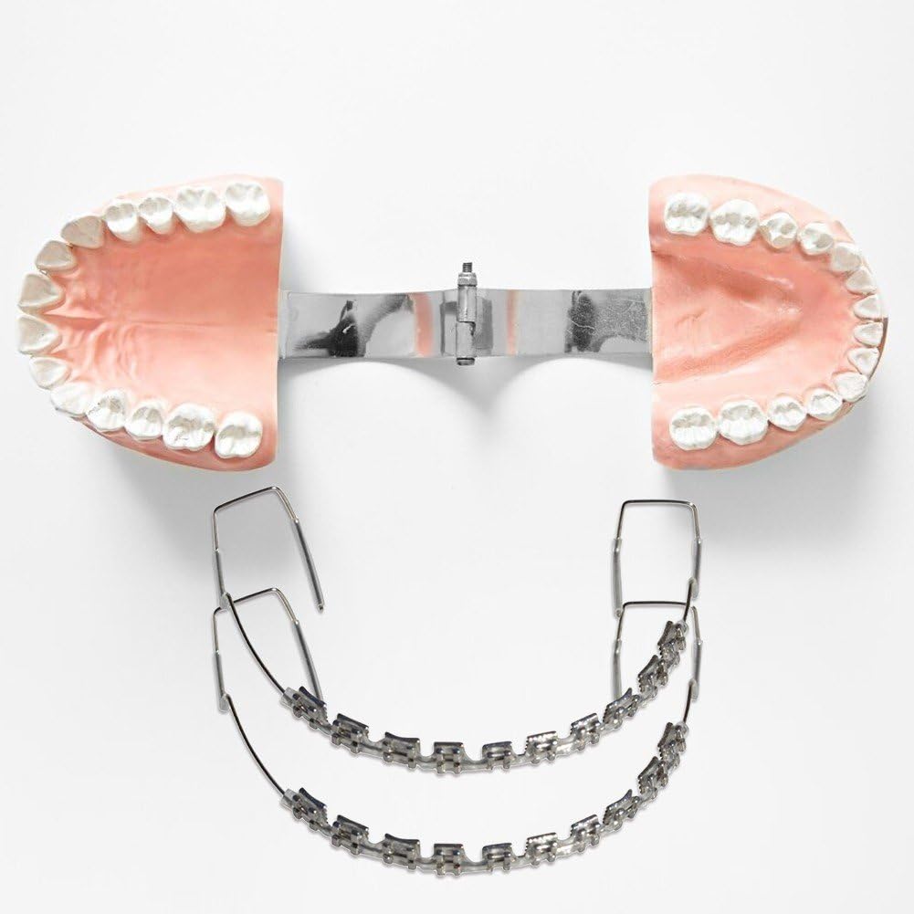 Wudaizhi 10 Bracket-typ, Transparenter Metall-Bracket-Haken, Temporäre Zahndekoration Metalldrähten Und Kieferorthopädischen Ligaturbändern, Zahndekorationen