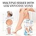 Hackerdom Varicose Veins Treatment for Legs, Varicose Veins Cream, Effectively Improves Blood Circulation, Relieves Leg Fatigue, Reduces Spider Veins