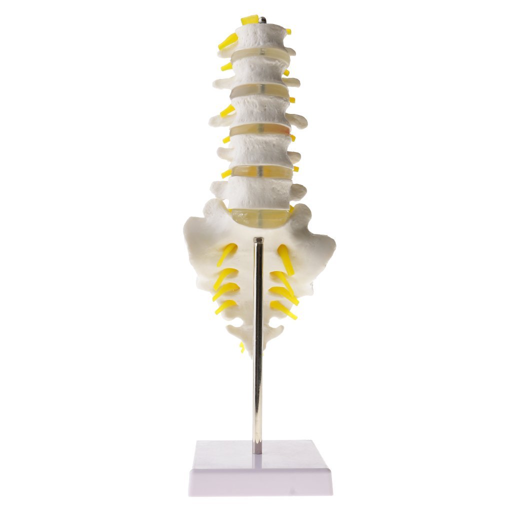 sjdoPulse Human Spine Model - Anatomical Model Lumbar Vertebrae/Sacrum & Coccyx, with Herniation Disc - Medical Anatomical Human Skeleton Model - for Medical Educational Training Aid