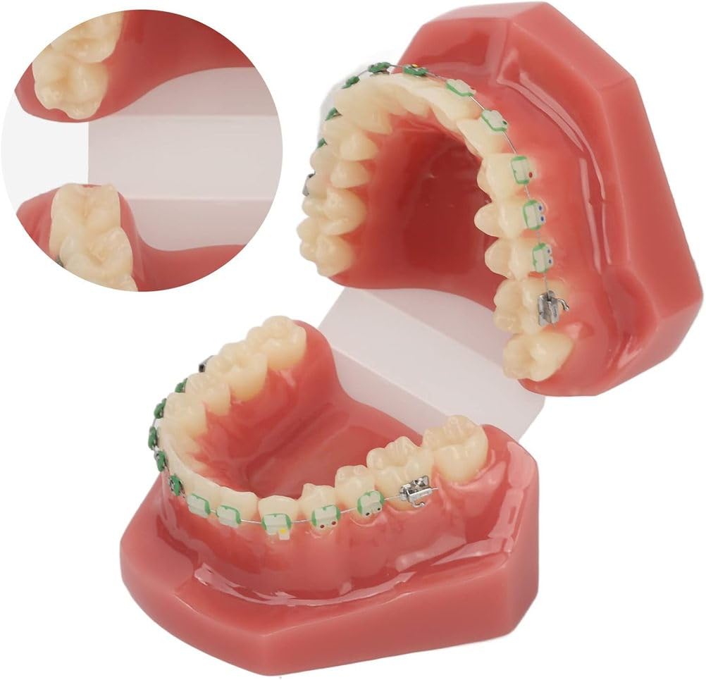 Modello di Ortodonzia Dentale,Modello di Ortodonzia Dentale in Resina,Modello di Ortodonzia Dentale Modello Dentale con Supporto di Fili Metallici per L'insegnamento