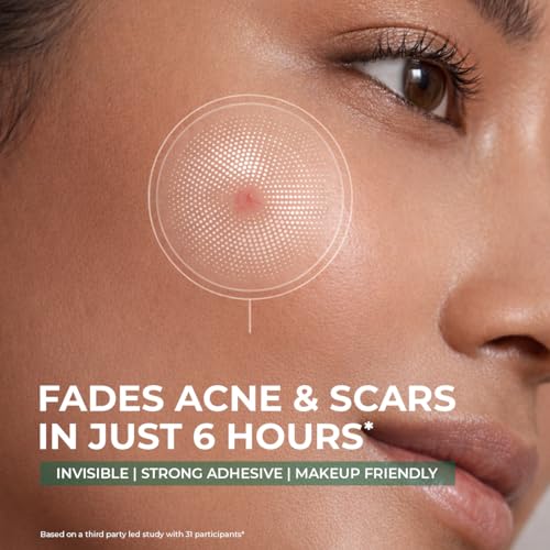 Image of Conscious Chemist Self Dissolving Microneedle Acne Patches (Pack of 8 Patches) | Painless & Effective Pimple Patches with 2% Salicylic Acid, Azelaic Acid & Niacinamide | Kills Bacteria, Reduces Redness, Scarring & Excess Sebum | Visible Results in 6 Hours